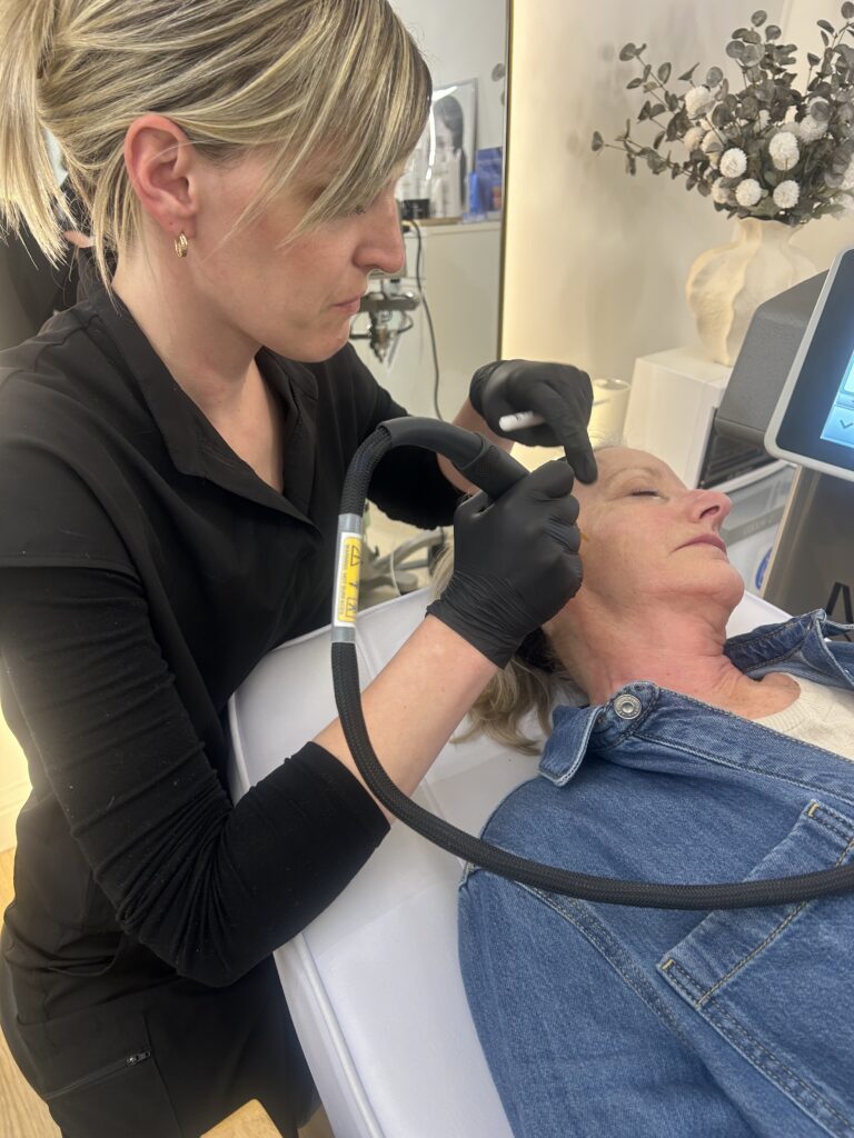 NeoGen plasma skin regeneration treatment at face oxford, jericho